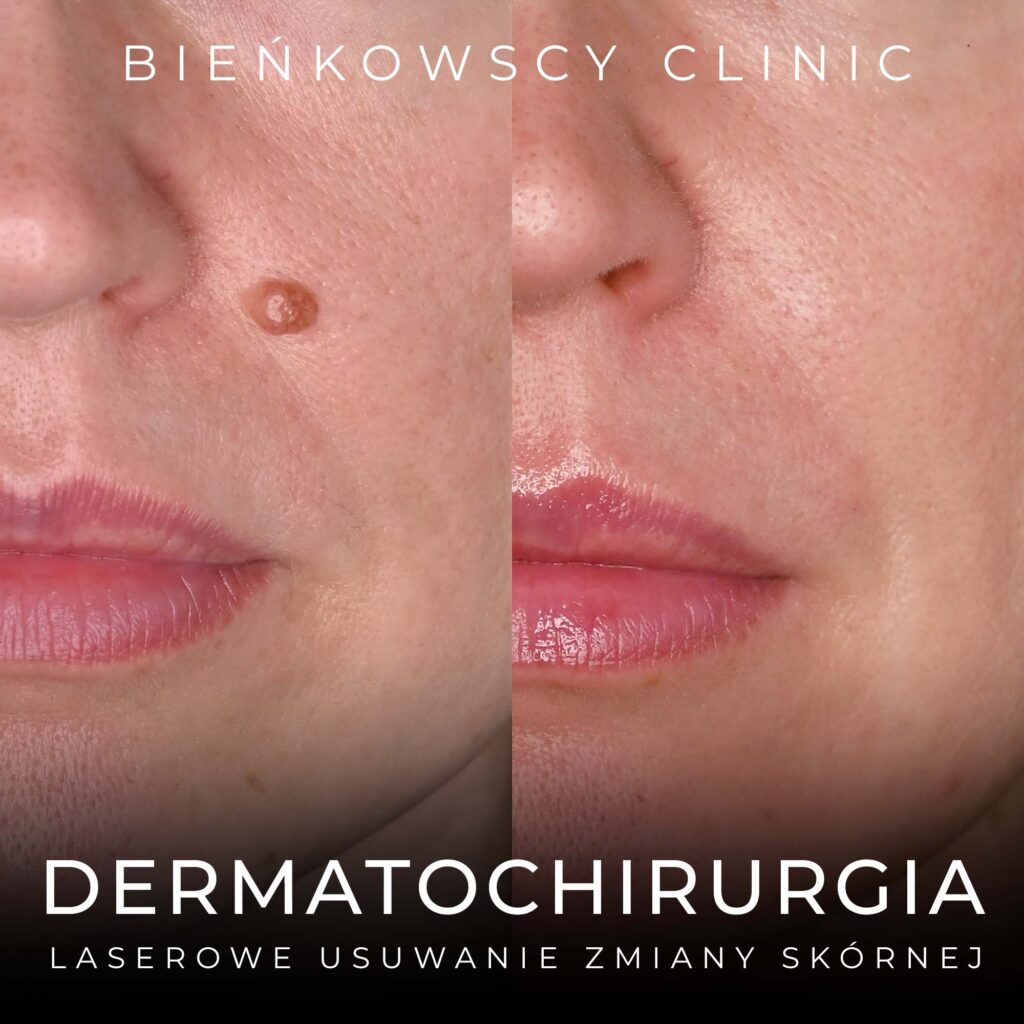 Dermatochirurgia, medycyna estetyczna i regeneracyjna w Częstochowie - Bieńkowscy Clinic
